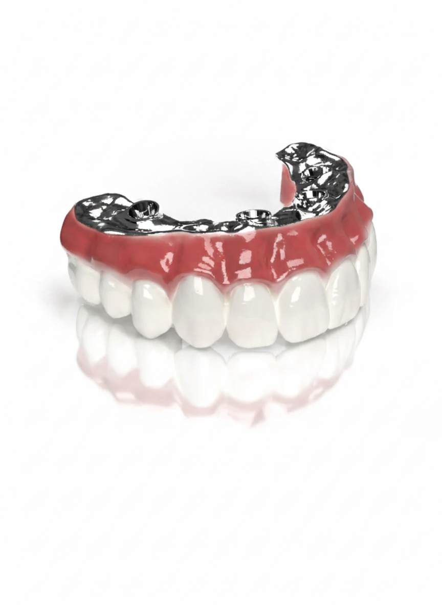 Full Arch (SmartMill Bar HT / Aidite)